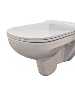 Záchody DEANTE Podstavný rám, pre závesné WC misy bez tlačidla + WC bez oplachového kruhu Edge + SEDADLO CST_WC01 X EG1