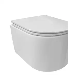 Kúpeľňa MEREO - WC závesné kapotované, RIMLESS, 495x360x370, keramické, vr. sedátka CSS113S VSD84S1