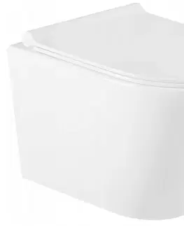Záchody MEXEN/S - Rico Závesná WC misa Rimless vrátane sedátka s slow-slim, Duroplast, biela - 30720500 30720500
